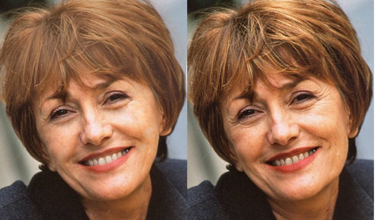 imágenes de rostros antes y después de los contornos